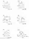 Fig. 03 - Method and device for stabilization of prosthetic devices