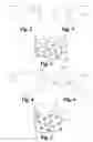 Fig. 02 - Shaped osteochondral grafts and methods of using same