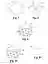 Fig. 03 - Shaped osteochondral grafts and methods of using same