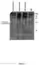Fig. 15 - Gene expression and production of TGF-β proteins including bioactive mullerian inhibiting substance from plants