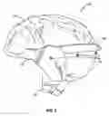 Fig. 03 - Armor for ballistic-resistant headgear