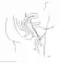 Fig. 01 - Hygienic commode for ladies with reverse sitting