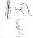 Fig. 03 - Toothbrush having a tongue scraper