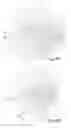 Fig. 07 - Implements with handles and working ends and method of use thereof