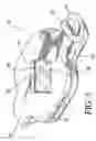 Fig. 04 - Shoelace retaining apparatus