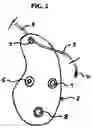 Fig. 03 - Accessory for shoelaces