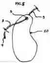 Fig. 06 - Accessory for shoelaces