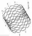 Fig. 05 - Tubular stent and methods of making the same
