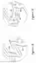 Fig. 06 - Tubular stent and methods of making the same