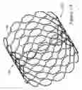 Fig. 07 - Tubular stent and methods of making the same