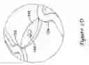 Fig. 10 - Tubular stent and methods of making the same