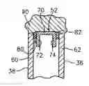 Fig. 01 - Method for repairing superalloy components using inserts