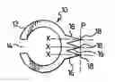 Fig. 01 - Tape breaking device