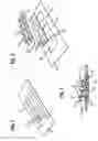 Fig. 02 - Device for determining the conductance of laundry, dryers and method for preventing deposits on electrodes