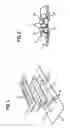 Fig. 04 - Device for determining the conductance of laundry, dryers and method for preventing deposits on electrodes