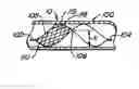 Fig. 01 - Spiral shaped filter