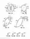 Fig. 07 - Spiral shaped filter