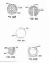 Fig. 30 - Spiral shaped filter
