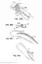 Fig. 40 - Spiral shaped filter