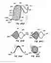 Fig. 48 - Spiral shaped filter