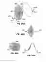 Fig. 50 - Spiral shaped filter