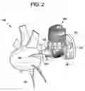 Fig. 03 - Vibration isolation engine mount system and method for ducted fans