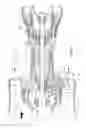 Fig. 04 - Accessory gearbox