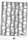 Fig. 04 - Disassemble covering