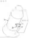 Fig. 06 - Installation structure of oil inclusion device and control unit thereof
