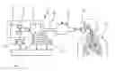 Fig. 01 - Method and device for detecting leaks in respiratory gas supply systems