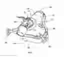 Fig. 02 - Patient interface with respiratory gas measurement component