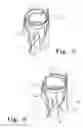 Fig. 05 - Tank sprayer with integrated measuring device