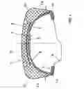 Fig. 02 - Non-pneumatic vehicle tire