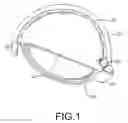 Fig. 02 - Model of a golf club head for molding