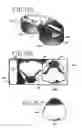 Fig. 34 - Packaging for disposable soft contact lenses