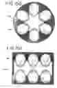 Fig. 35 - Packaging for disposable soft contact lenses