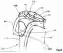 Fig. 07 - Ergonomic golf bag handle
