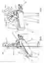 Fig. 09 - Ergonomic golf bag handle