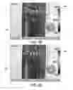 Fig. 20 - Visible light and IR combined image camera