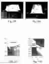 Fig. 14 - Gallium nitride material devices including an electrode-defining layer and methods of forming the same