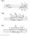 Fig. 02 - Method for encapsulating an electrical component, and surface acoustic wave device encapsulated using said method
