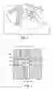 Fig. 05 - Gapless piston ring for preventing blow-by