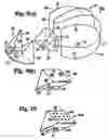 Fig. 06 - Twin airbag