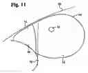 Fig. 07 - Twin airbag