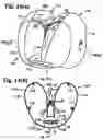 Fig. 10 - Twin airbag