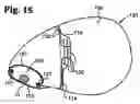 Fig. 11 - Twin airbag