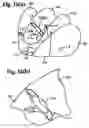 Fig. 12 - Twin airbag
