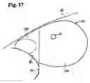 Fig. 13 - Twin airbag