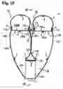 Fig. 15 - Twin airbag