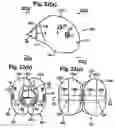 Fig. 18 - Twin airbag